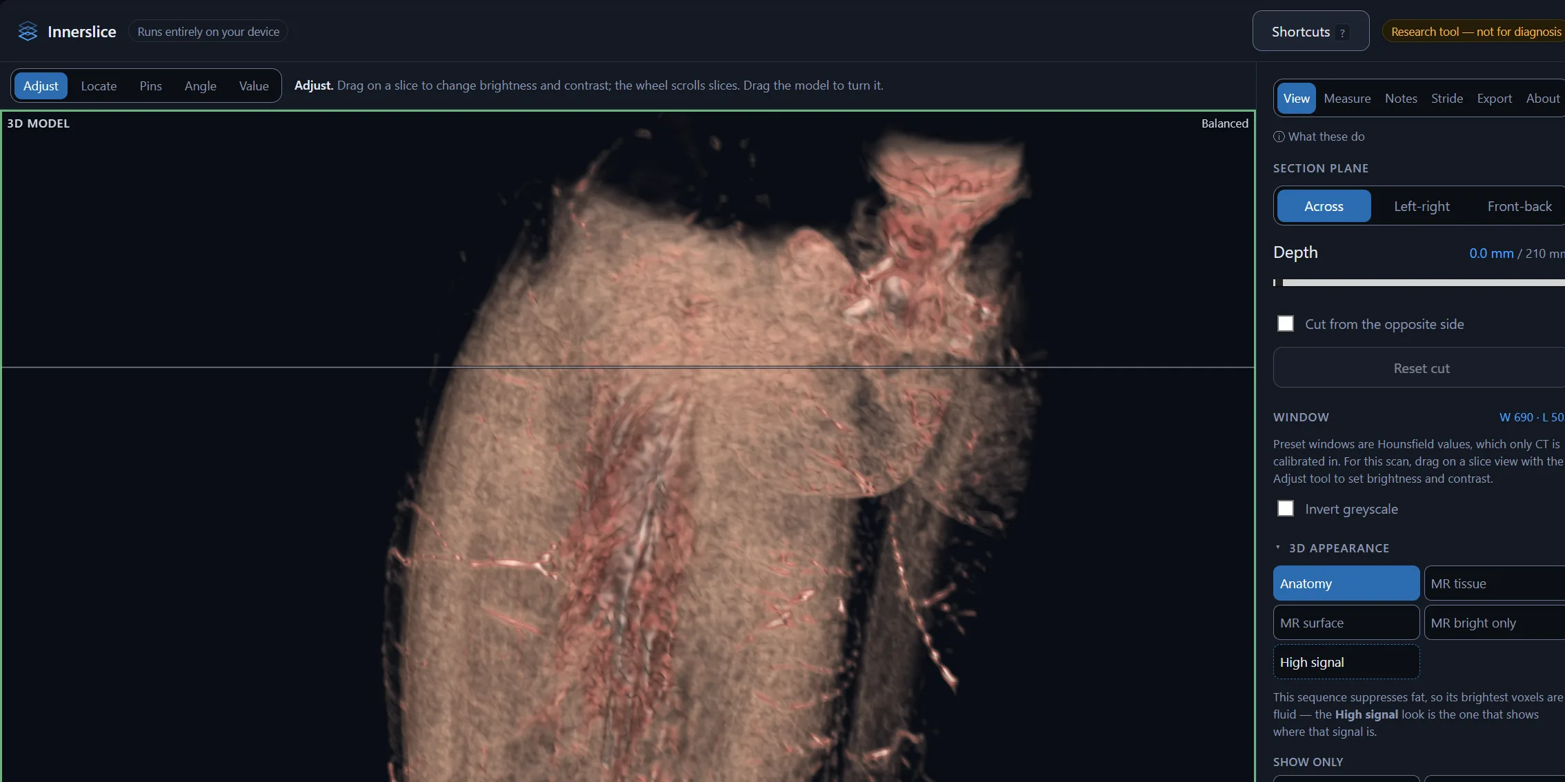 Innerslice 3D model of an MRI