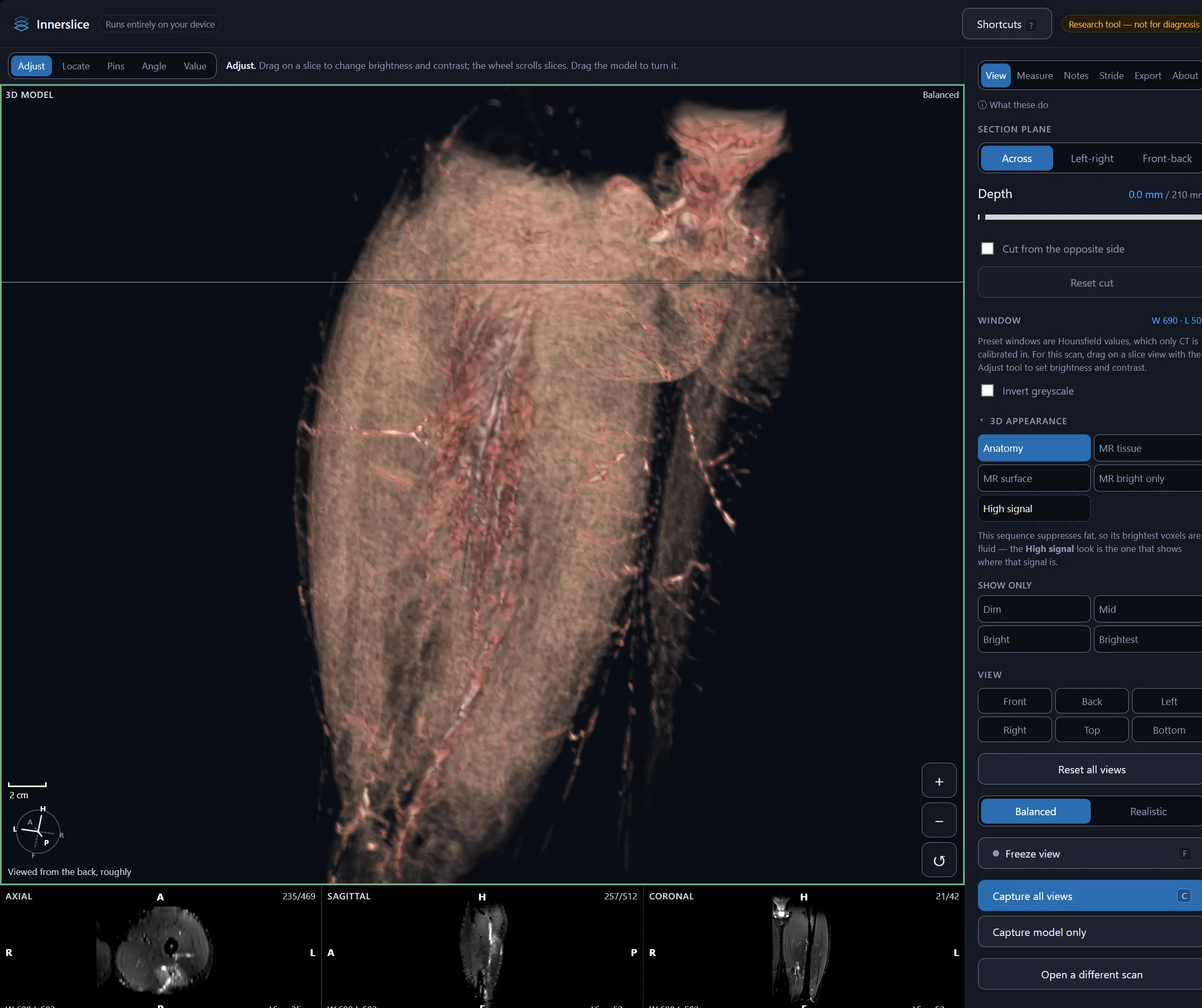 Innerslice screenshot: 3D model of a hamstring MRI with the section plane